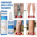 VariBooster Clear - Spray para Tratamento de Varizes