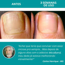 Site Oficial do Adesivo MicoBand