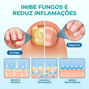 Site Oficial do Adesivo MicoBand