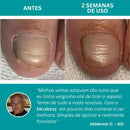 Site Oficial do Adesivo MicoBand