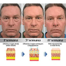 Site Oficial Joypretty - Elimina Olheiras, Rugas e Bolsas dos Olhos